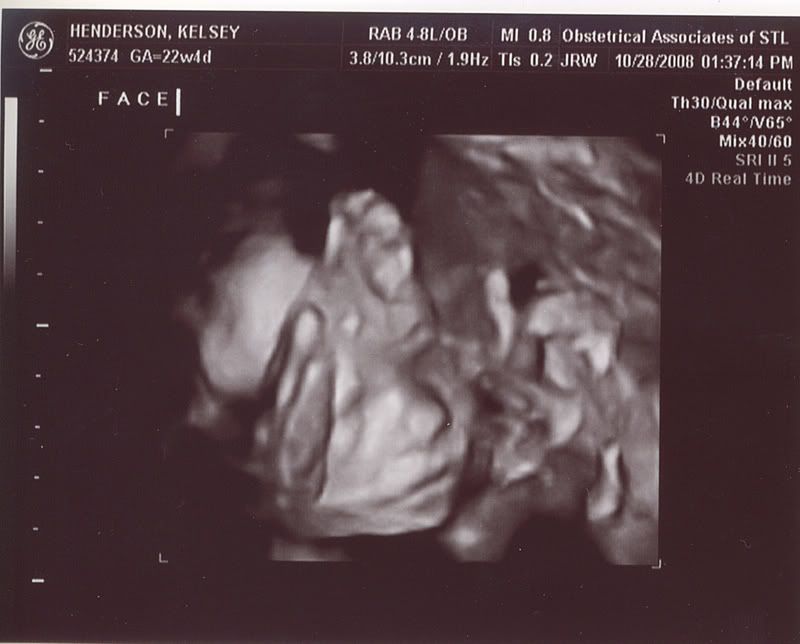 3d ultrasound scan. 27 week 3d Ultrasound