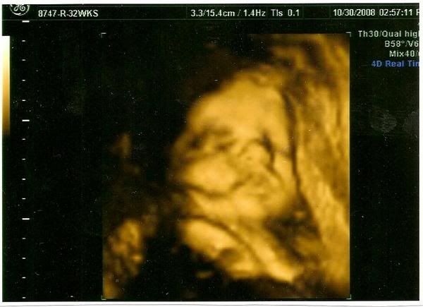 27-Weeks-Pregnancy-3D-Ultrasound http://www.amazingpregnancy-pictures.com/photopost/third-trimester27 ...